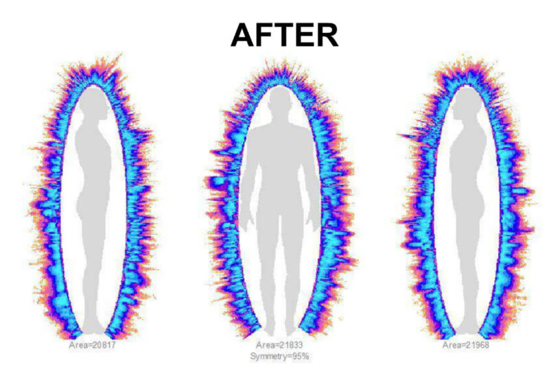 Life Source - Energy After2